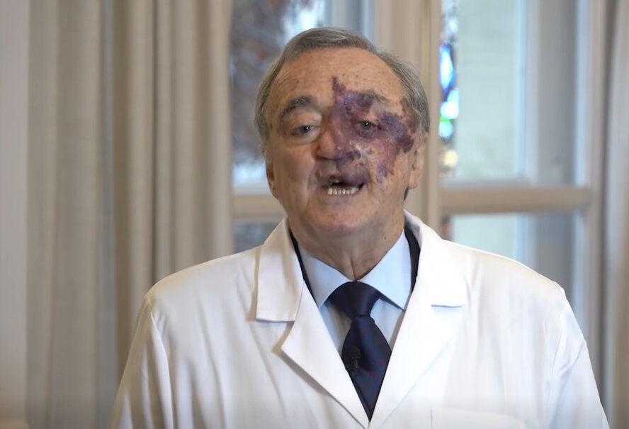 průlom rakovina slinivky